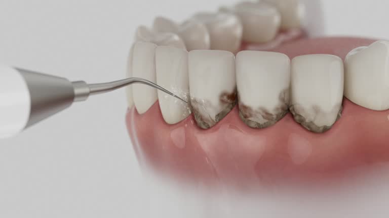 Reliable Dental Implants contractor in Wickes, AR by Smile Center Dentistry